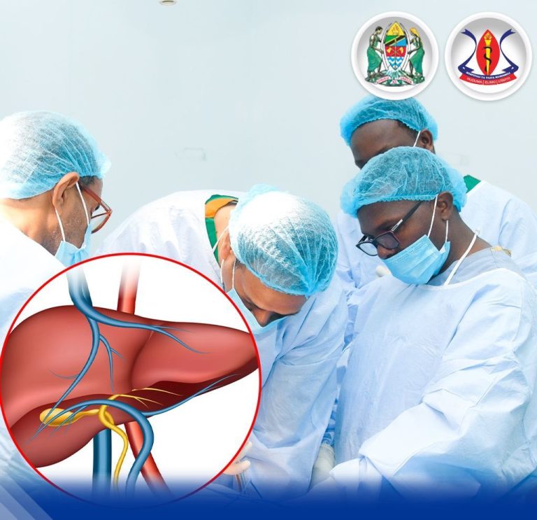 Upandikizaji ini Muhimbili sasa ni 2025